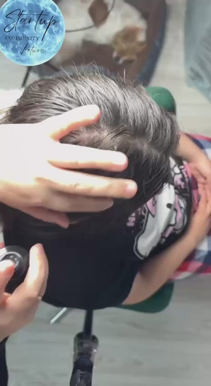 Nuova Skin purškiamasis losjonas nuo pleiskanų 150ml